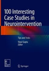 100 Interesting Case Studies in Neurointervention: Tips and Tricks