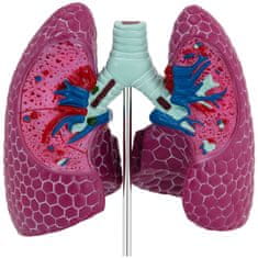 NEW 3D anatomski model človeških pljuč s poškodbami