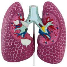 NEW 3D anatomski model človeških pljuč s poškodbami