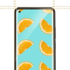 Miramarket 3D Edge Nano Flexi Glass kaljeno steklo za celoten zaslon z okvirjem za Xiaomi Mi 11 / 11 Pro