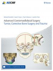 Advanced Craniomaxillofacial Surgery