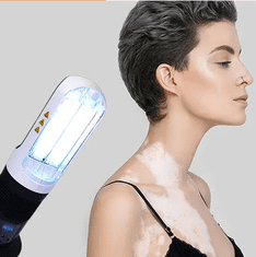 GLOBLIGHT Lampa UVB za luskavico 311 nm 18 W vitiligo atopijski ekcem