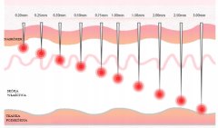 Miramarket Komplet Dermaroller + 3 zamenljive konice za mezoterapijo obraza in telesa