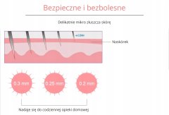 Miramarket Komplet Dermaroller + 3 zamenljive konice za mezoterapijo obraza in telesa