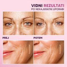 ROSSEN Natural ANTI-AGE serum za nego obraza