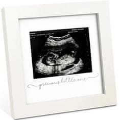 KeaBabies Okvir za ultrazvočno sliko – spominski okvir “Precious Little One”
