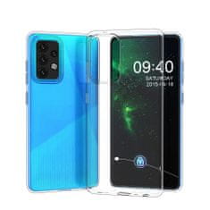 MG Ultra Clear 0.5mm silikonski ovitek za Xiaomi Redmi Note 10 / Redmi Note 10S, prozoren