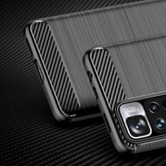 slomart carbon case flexible case ovitek xiaomi redmi note 11 pro+ 5g (kitajska) / 11 pro 5g (kitajska) / mi11i hypercharge / poco x4 nfc črn