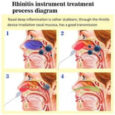 Tavalax Tavalax dravljenje nos Laser Rinitis, Sinusitis Zdravilo za