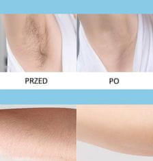 Miramarket IPL lasersko odstranjevanje dlak epilator močan učinkovit